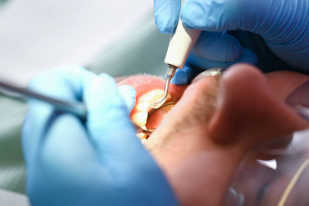 Best Pediatric Emergency Dentist in Beechwood Village, KY